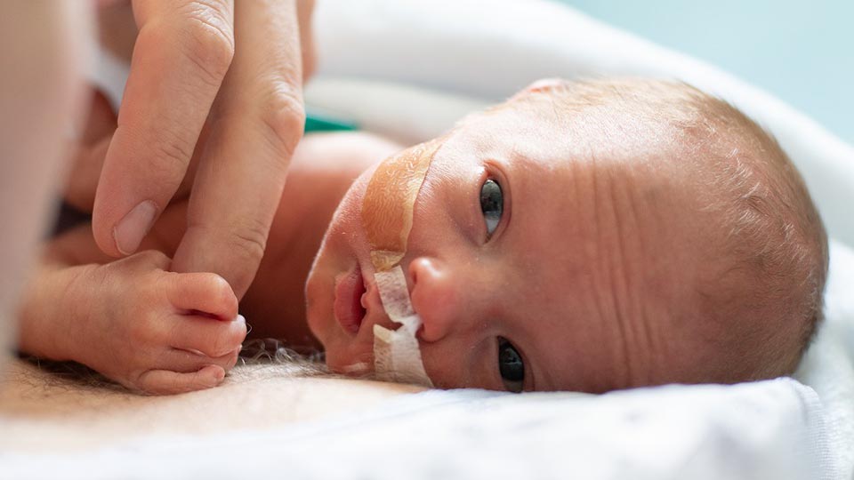 Newborn baby with a nasal feeding tube